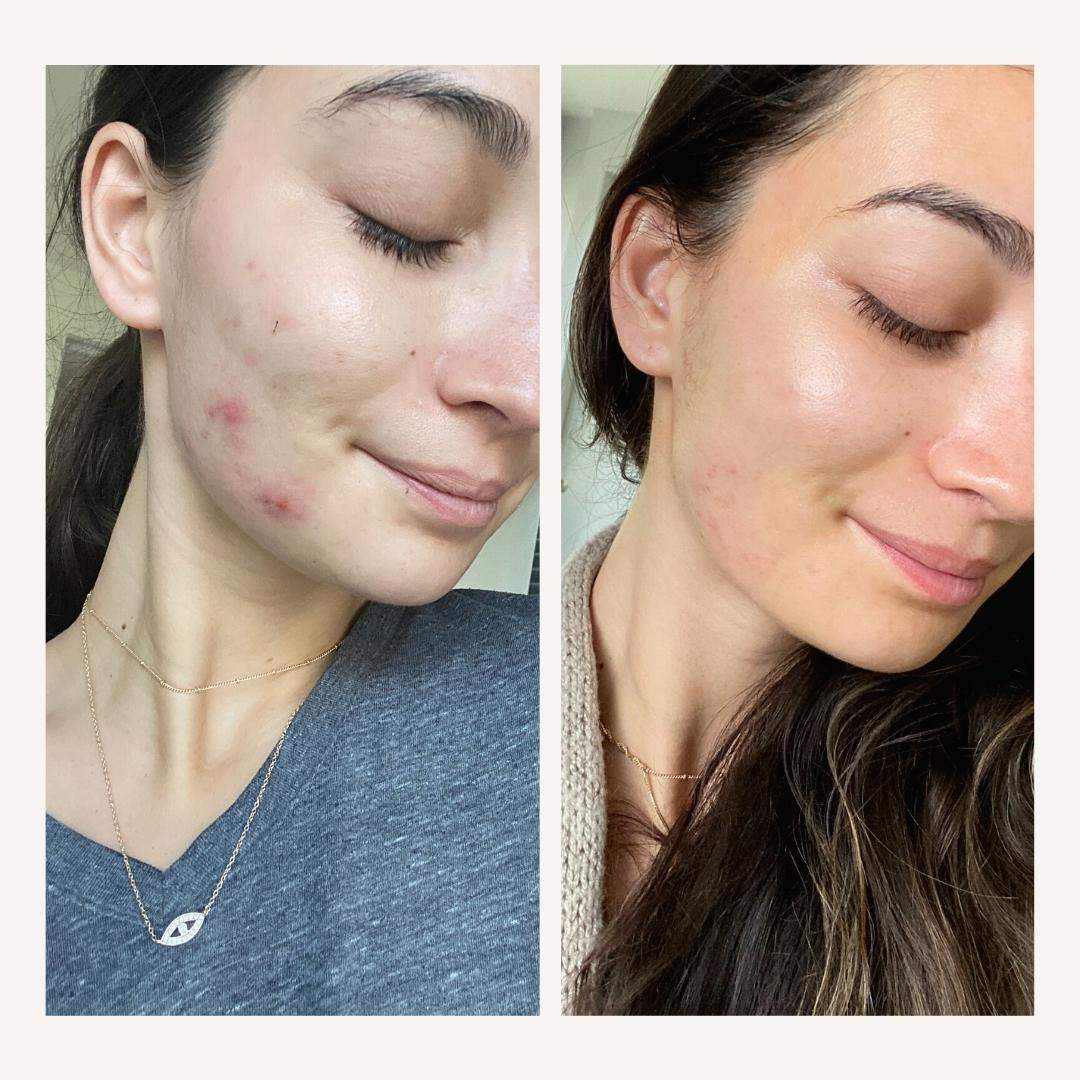 Hyaluronic Acid Serum - WellNature