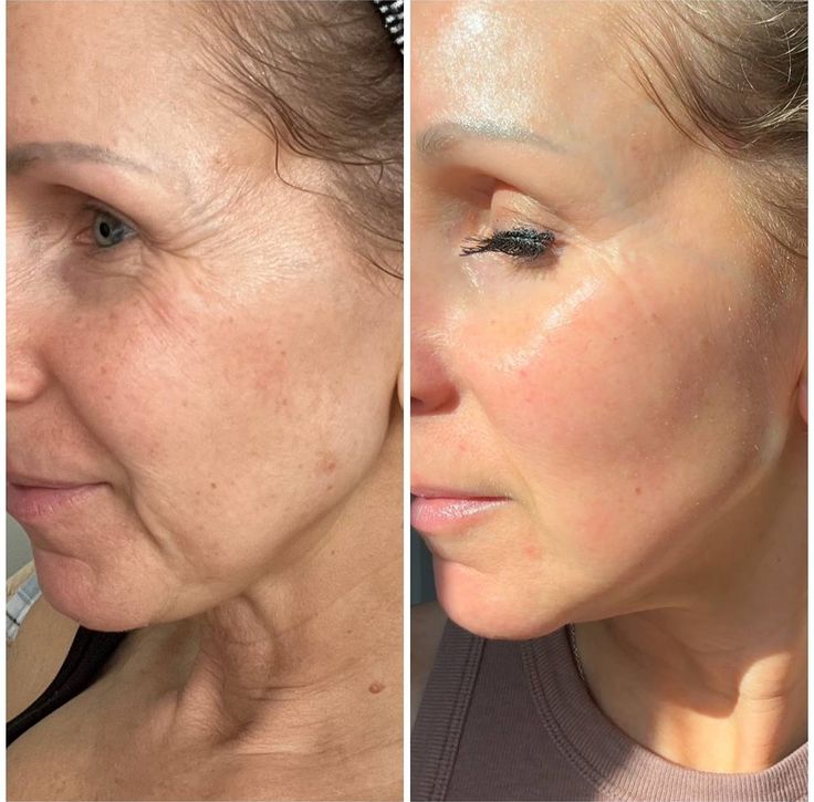 The Original Overnight Deep Collagen Mask™️ - WellNature