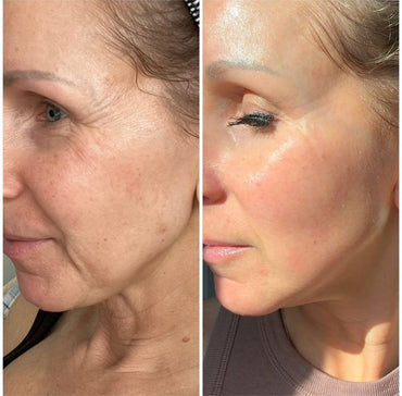 The Original Overnight Deep Collagen Mask™️ - WellNature