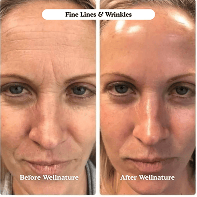 The Original Overnight Deep Collagen Mask™️ - WellNature