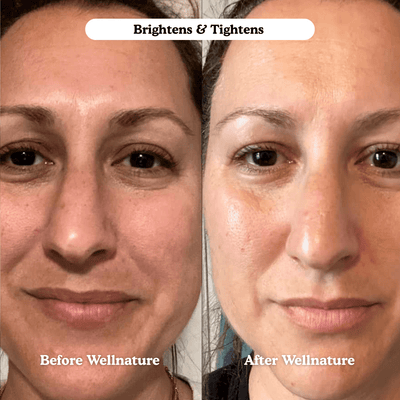 The Original Overnight Deep Collagen Mask™️ - WellNature