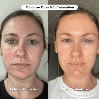 The Original Overnight Deep Collagen Mask™️ - WellNature