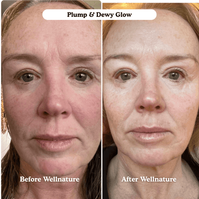 The Original Overnight Deep Collagen Mask™️ - WellNature