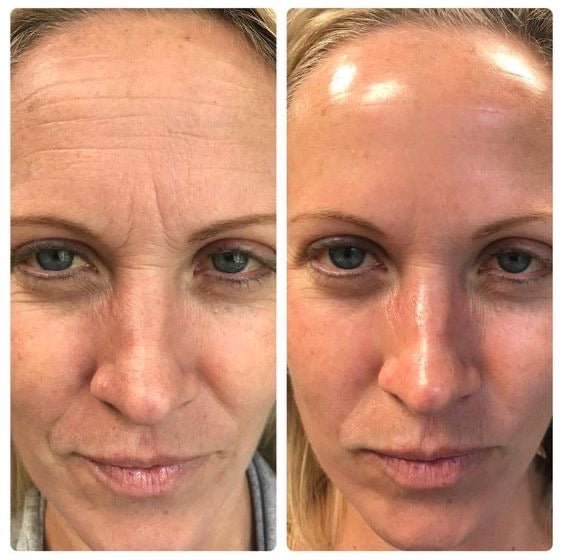 The Original Overnight Deep Collagen Mask - WellNature