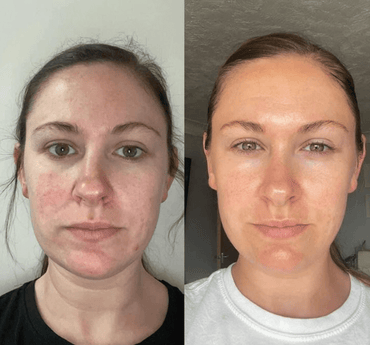 The Original Overnight Deep Collagen Mask™️ - WellNature