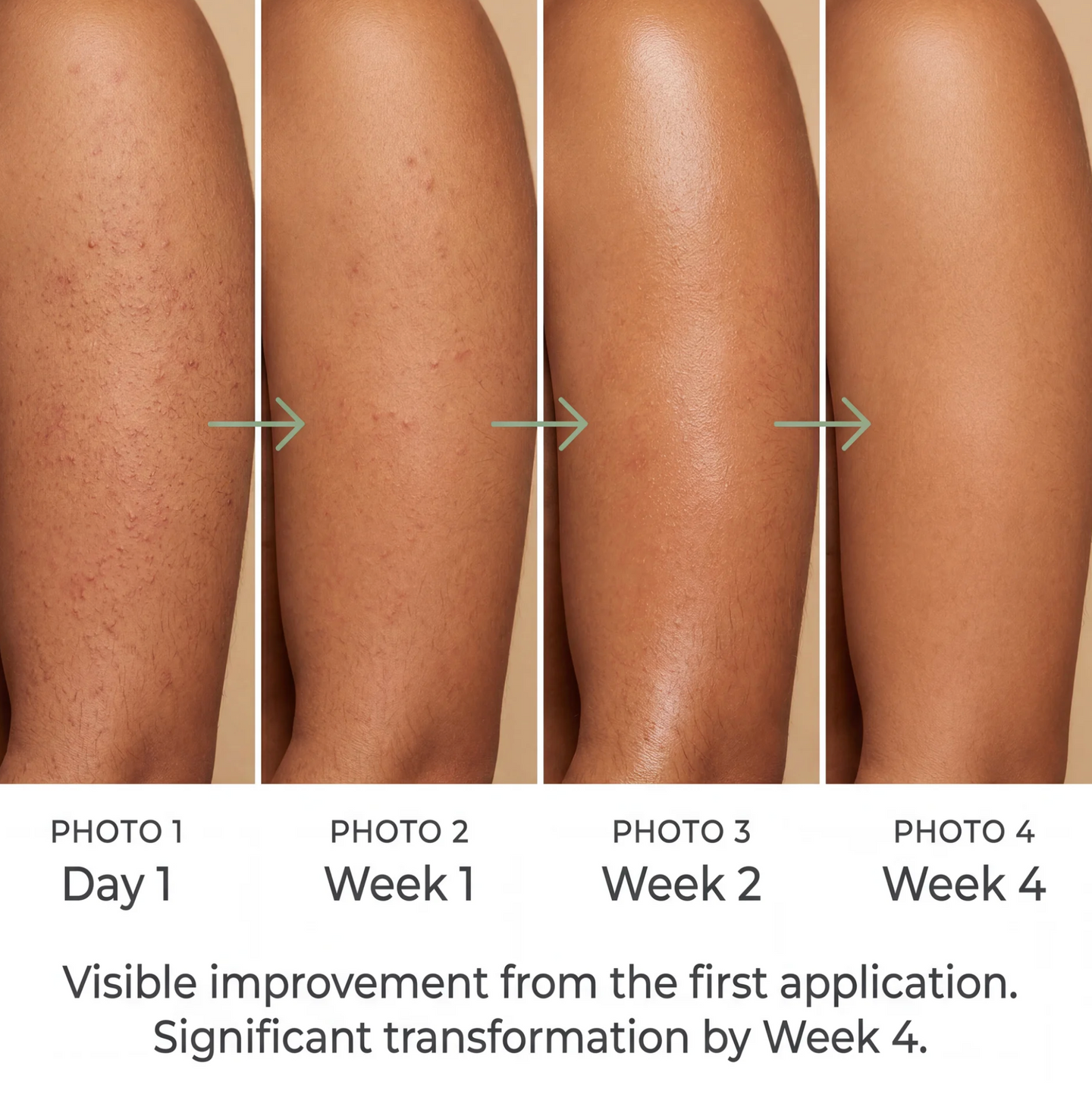 92% smoother skin in 2 weeks