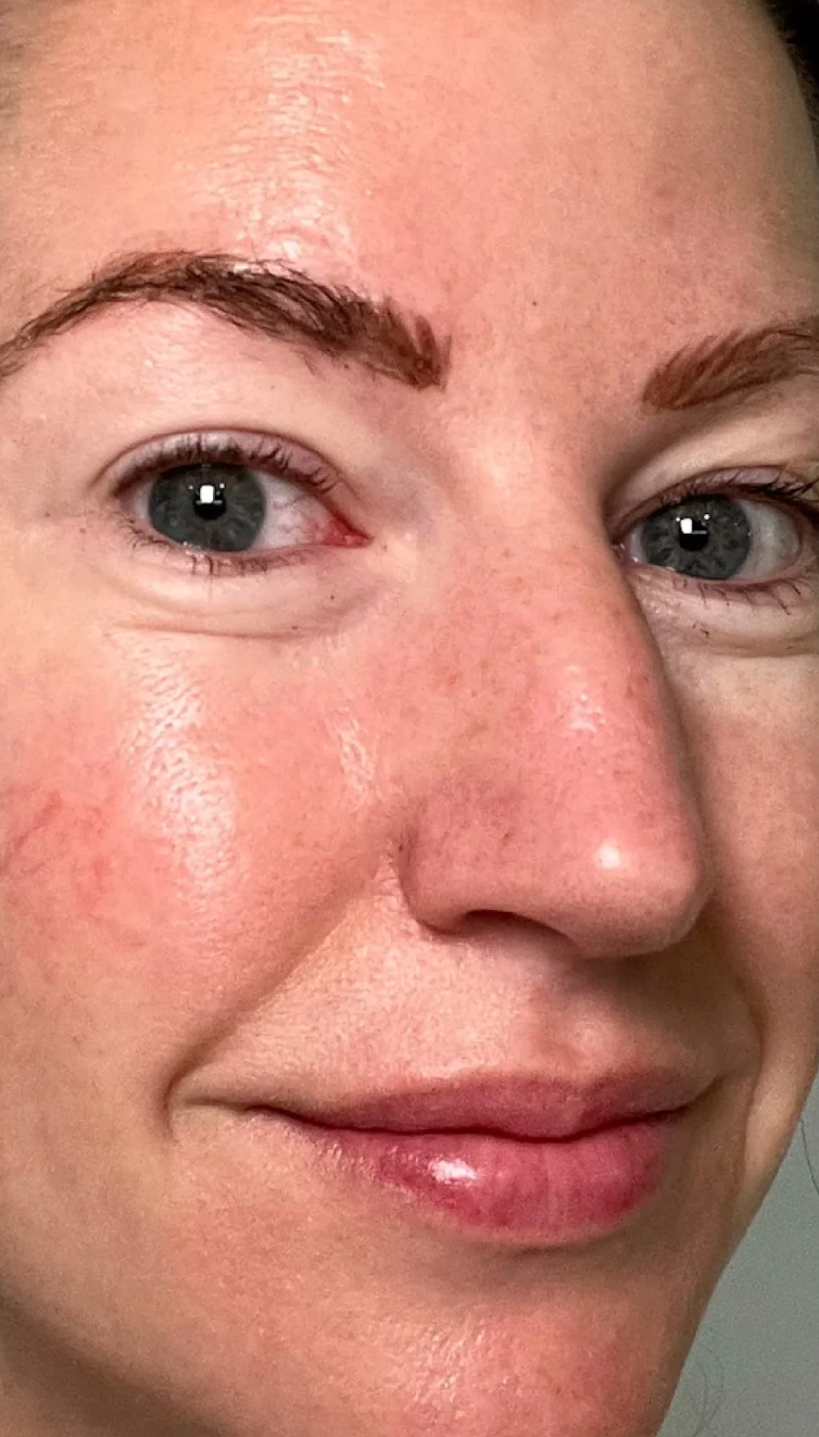 After using the mask