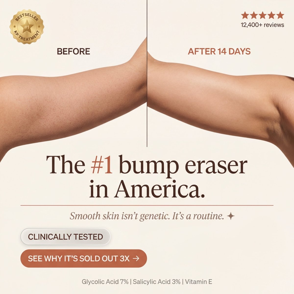 WellNature Bump Eraser Scrub close-up texture