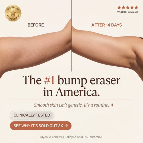 KP Bump Eraser