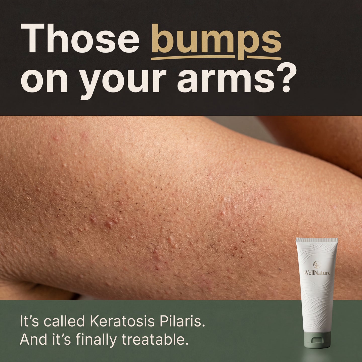 Woman touching her smooth arm skin