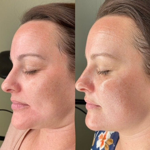 Original Deep Collagen Mask - 4 Week Glow Challenge