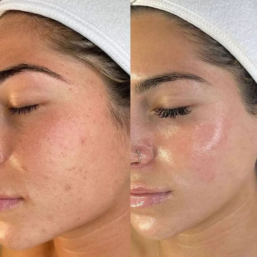 Original Deep Collagen Mask - 4 Week Glow Challenge - WellNature