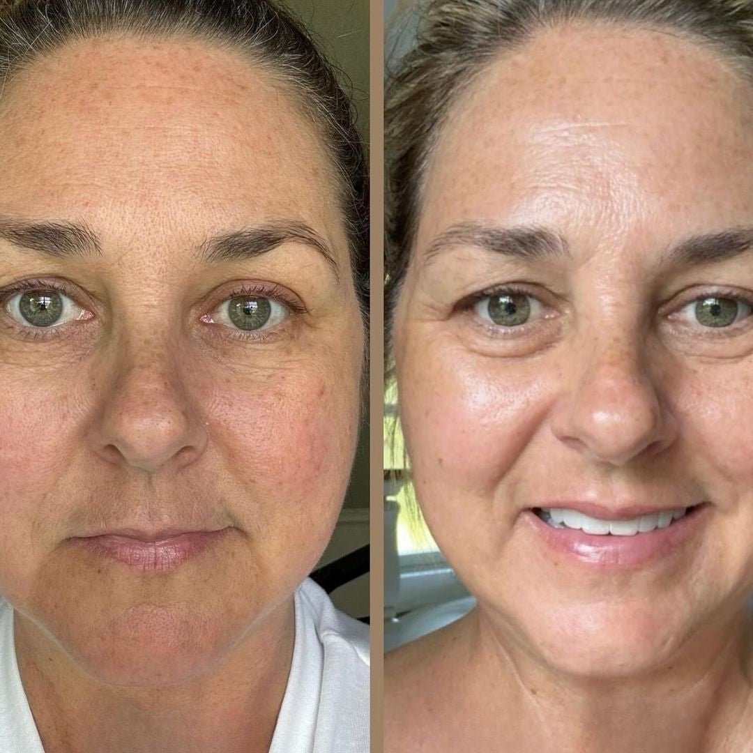 The Original Overnight Deep Collagen Mask™️ - WellNature