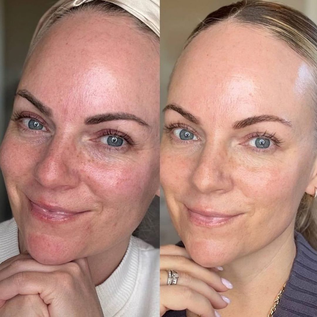 The Original Overnight Deep Collagen Mask™️ - WellNature