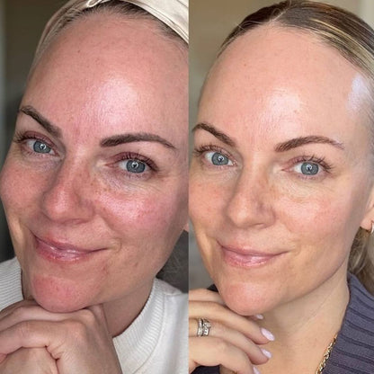 The Original Overnight Deep Collagen Mask™️ - WellNature