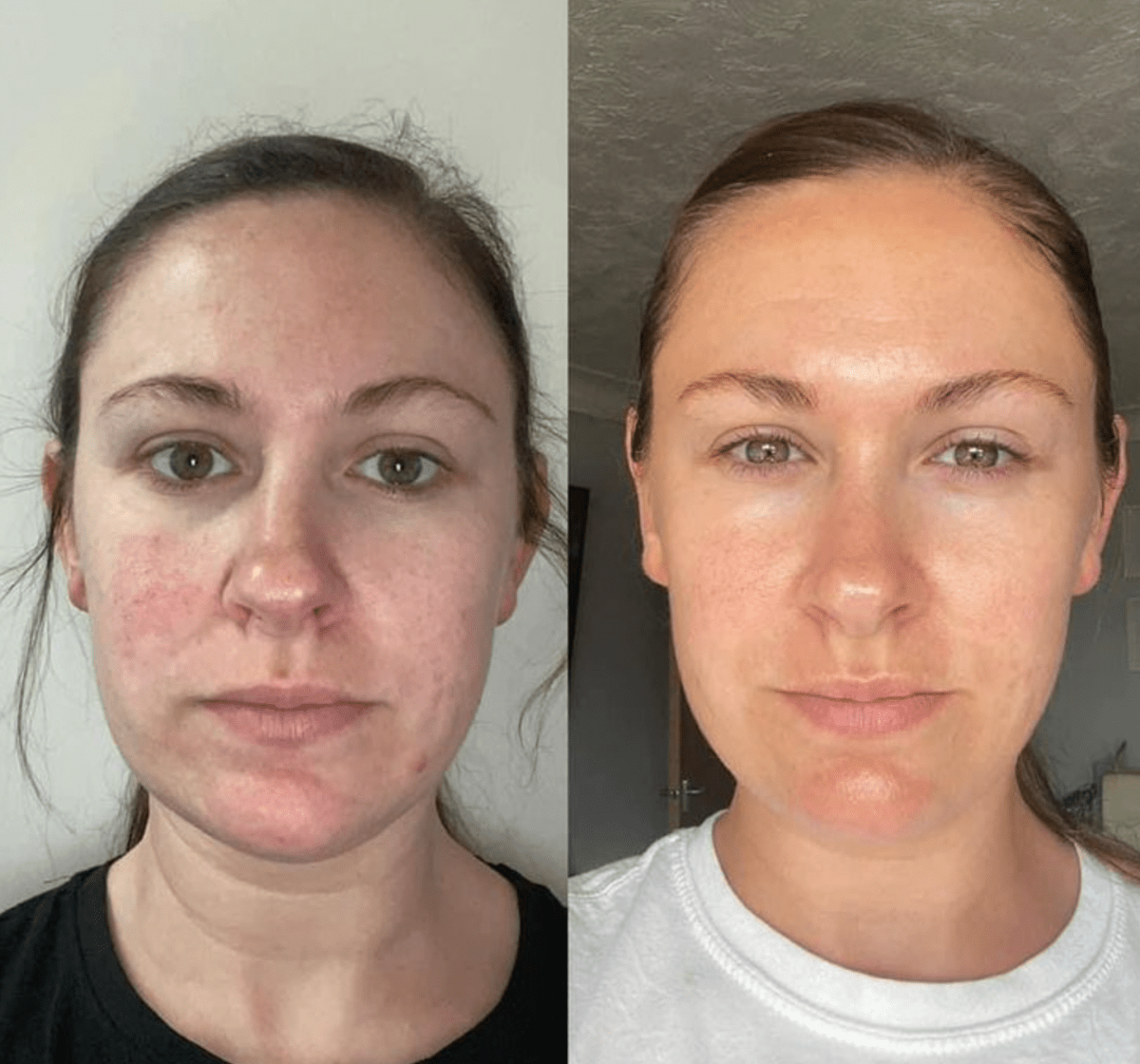 The Original Overnight Deep Collagen Mask™️ - WellNature