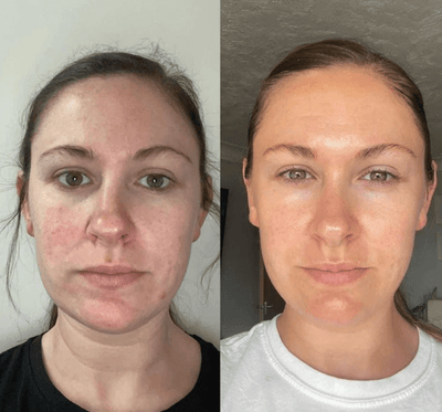 The Original Overnight Deep Collagen Mask™️ - WellNature