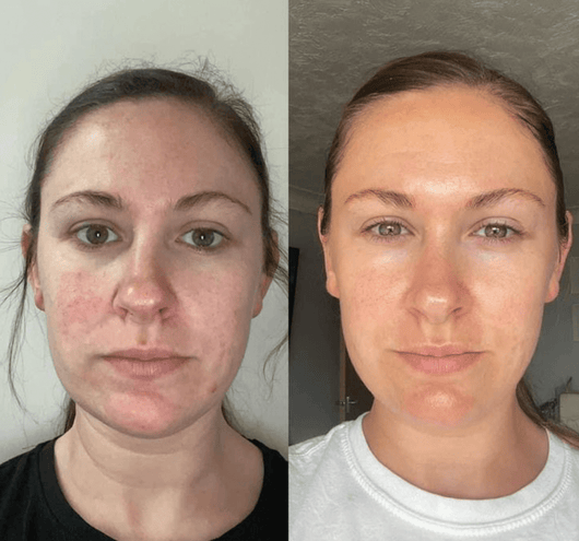 The Original Overnight Deep Collagen Mask™️ - WellNature