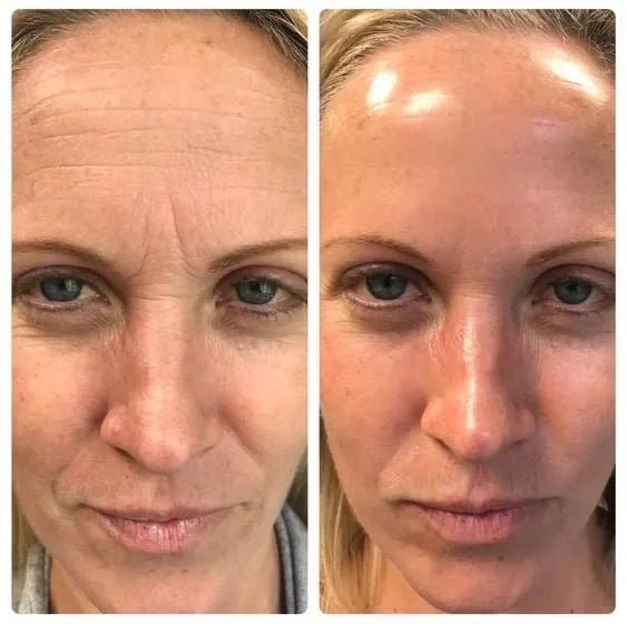 The Original Overnight Deep Collagen Mask™️ - WellNature