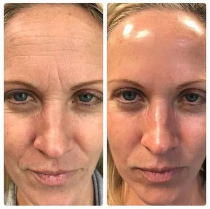 The Original Overnight Deep Collagen Mask™️ - WellNature